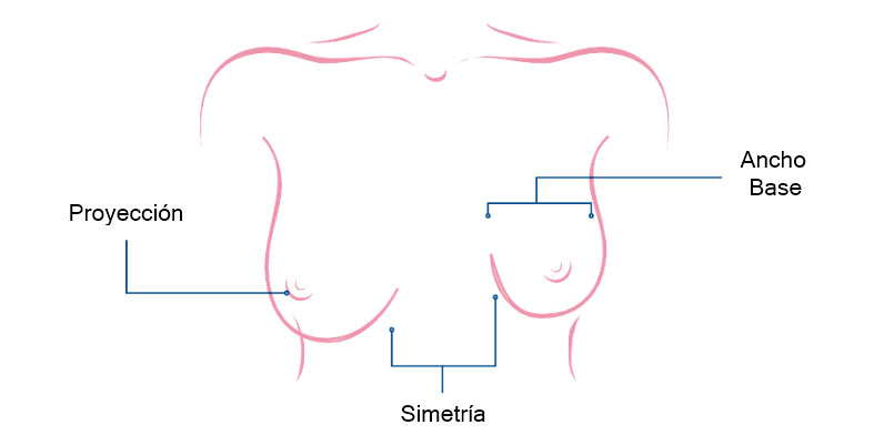 Implantes mamarios: proyección, simetría, ancho base y volumen